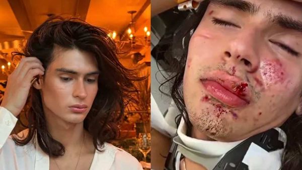 Police Investigating Hate Crime after Out Model Allegedly Attacked by Mob of 'More Than Ten' Assailants